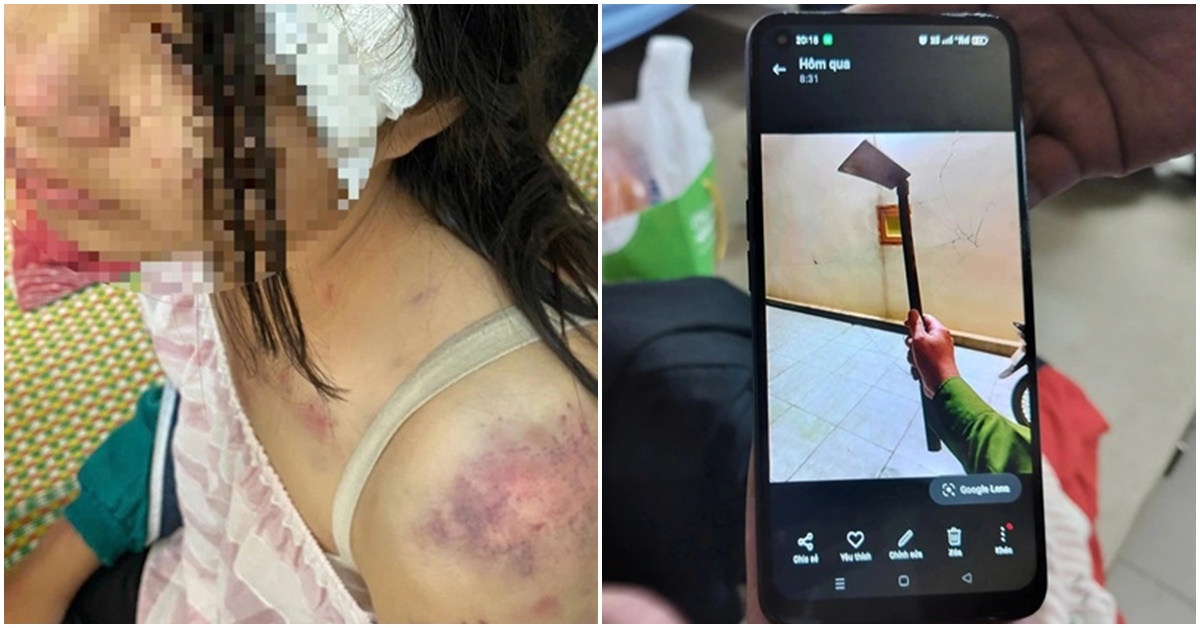 4 giờ là ‘địa ngục’ với bé gái 12 tuổi bị bà nội và người thân bạo hành, 1 cú nhảy đã cứu sống em