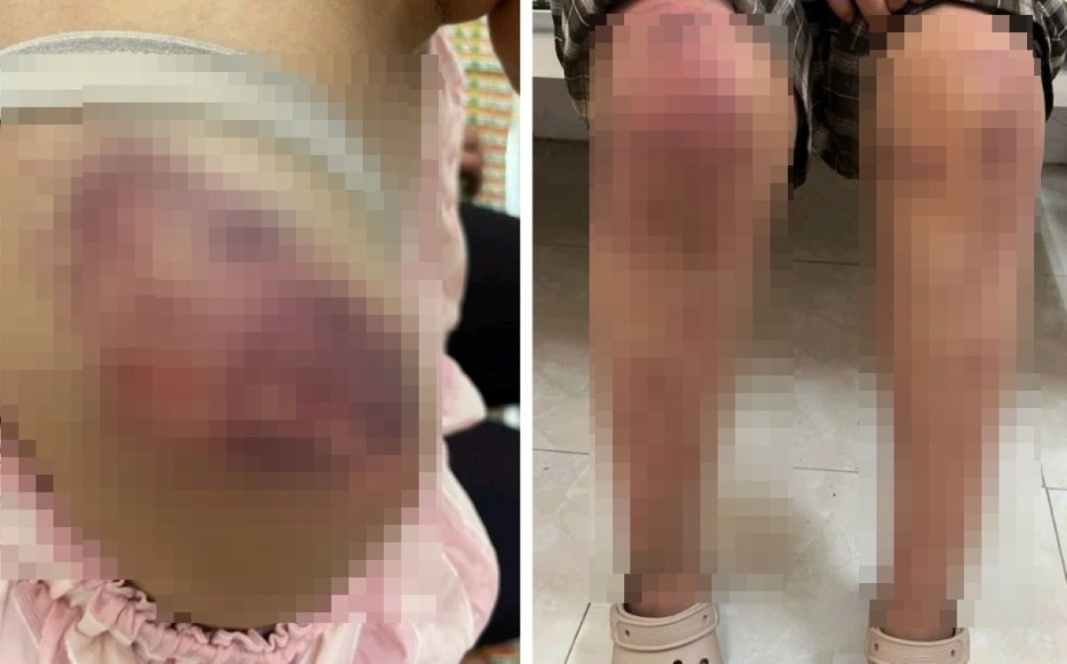 Vụ cháu bé 13 tuổi bị ông bà nội hành hạ dã man ở Thái Nguyên: Mức án nặng đang chờ các đối tượng?