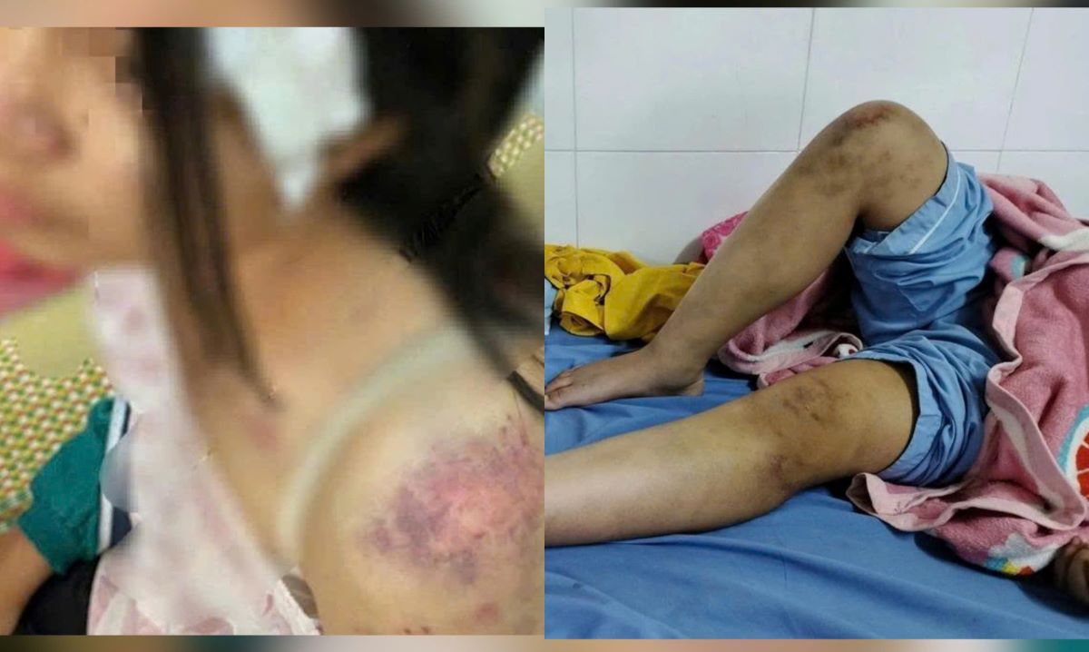 Sau vụ bé gái 12 tuổi ở Thái Nguyên bị bạo hành: Cư dân mạng bức xúc ‘bóc phốt’
