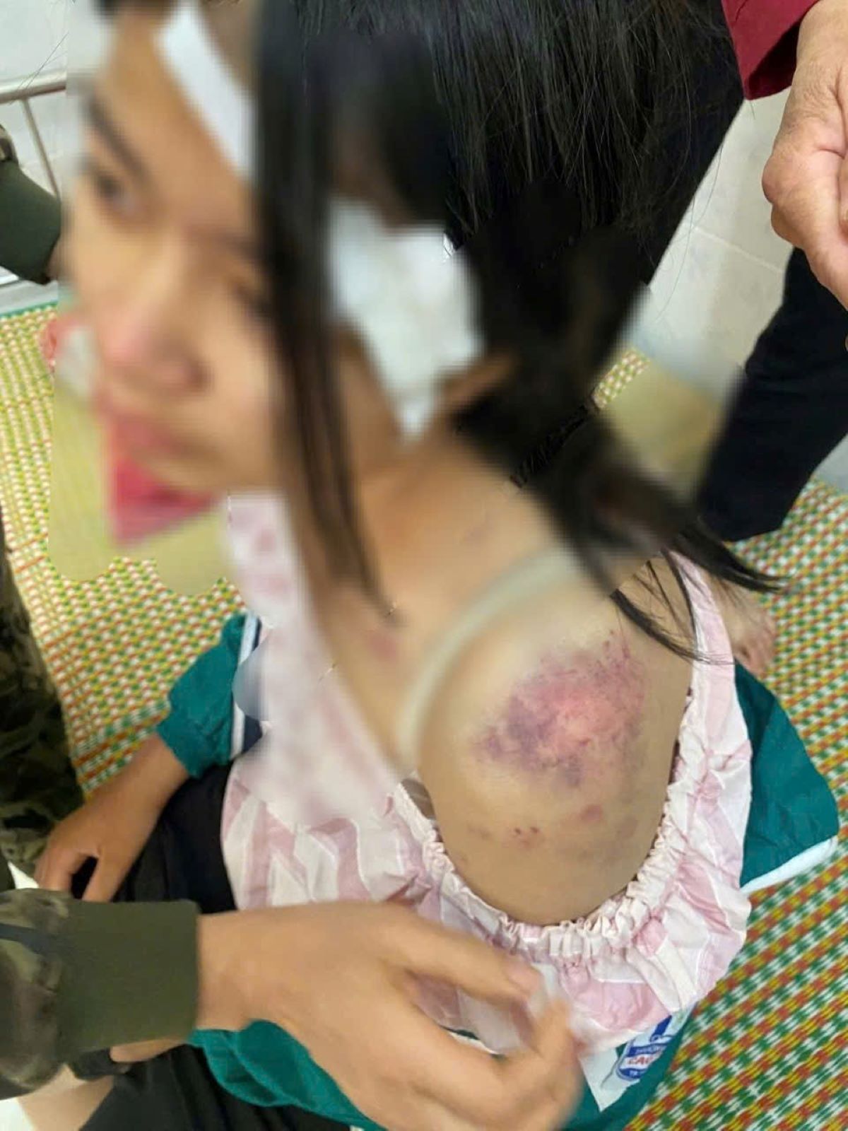 Đã có kết quả giám định thương tật vụ bé gái bị bà nội và 2 người đàn ông hành hạ gây bức xúc