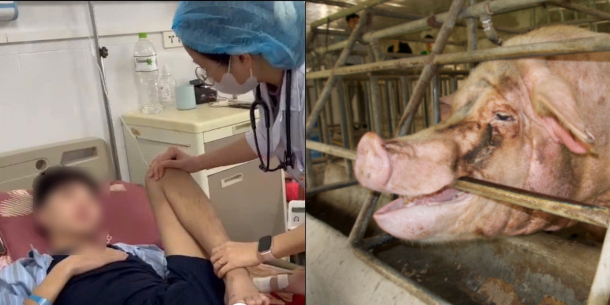 Tình hình sức khỏe của nam thiếu niên bị lợn cắn tại Sơn La sau 1 tháng điều trị 