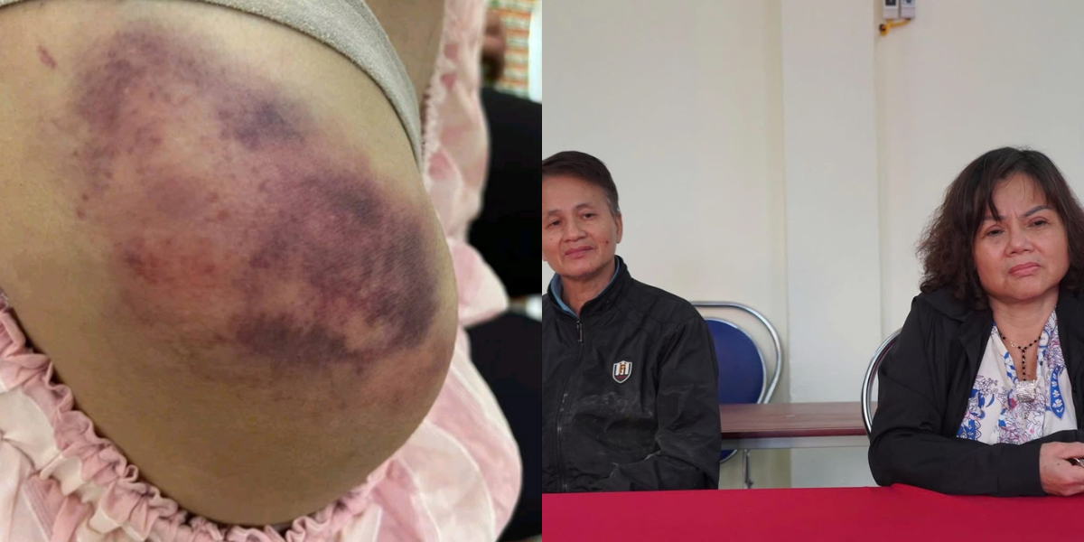 Lời kể xót xa của bà ngoại bé gái 14 tuổi bị nhà nội bạo hành dã man ở Thái Nguyên
