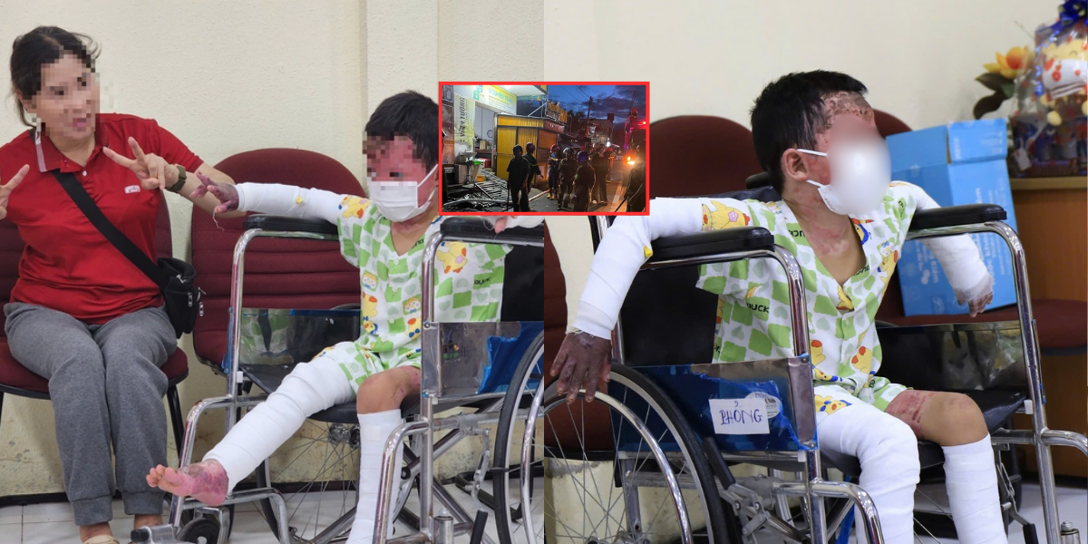 Bé trai 5 tuổi bị bỏng 65% trong vụ phóng hỏa Gia Lai hồi sinh ngoạn mục