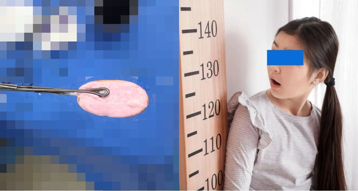 TP.HCM: Bé gái 12 tuổi cấp cứu vì nhét cục xà bông vào ‘nơi riêng tư’, bác sĩ cảnh báo khẩn