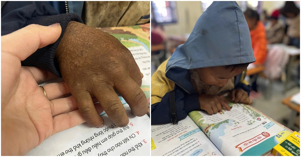 Câu chuyện xúc động đằng sau bức ảnh bàn tay sạm đen, nứt nẻ của em bé 8 tuổi ở vùng cao