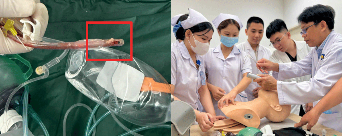 Bé 3 tuổi tử vong do sặc thức ăn: Trường mầm non bỏ lỡ giờ vàng, qua 2 trạm y tế trước khi gọi 115