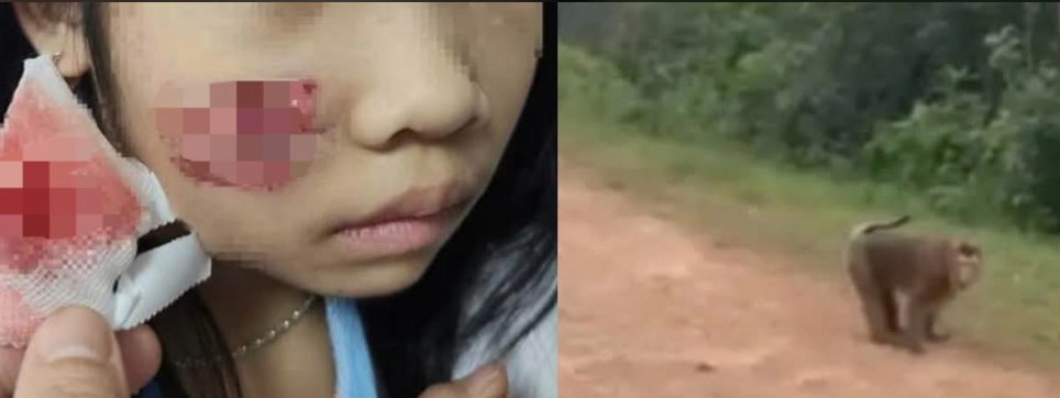 Con khỉ hoang ở Quảng B&igrave;nh tấn c&ocirc;ng 5 người: Ch&aacute;u b&eacute; 7 tuổi phải nhập viện với nhiều vết thương