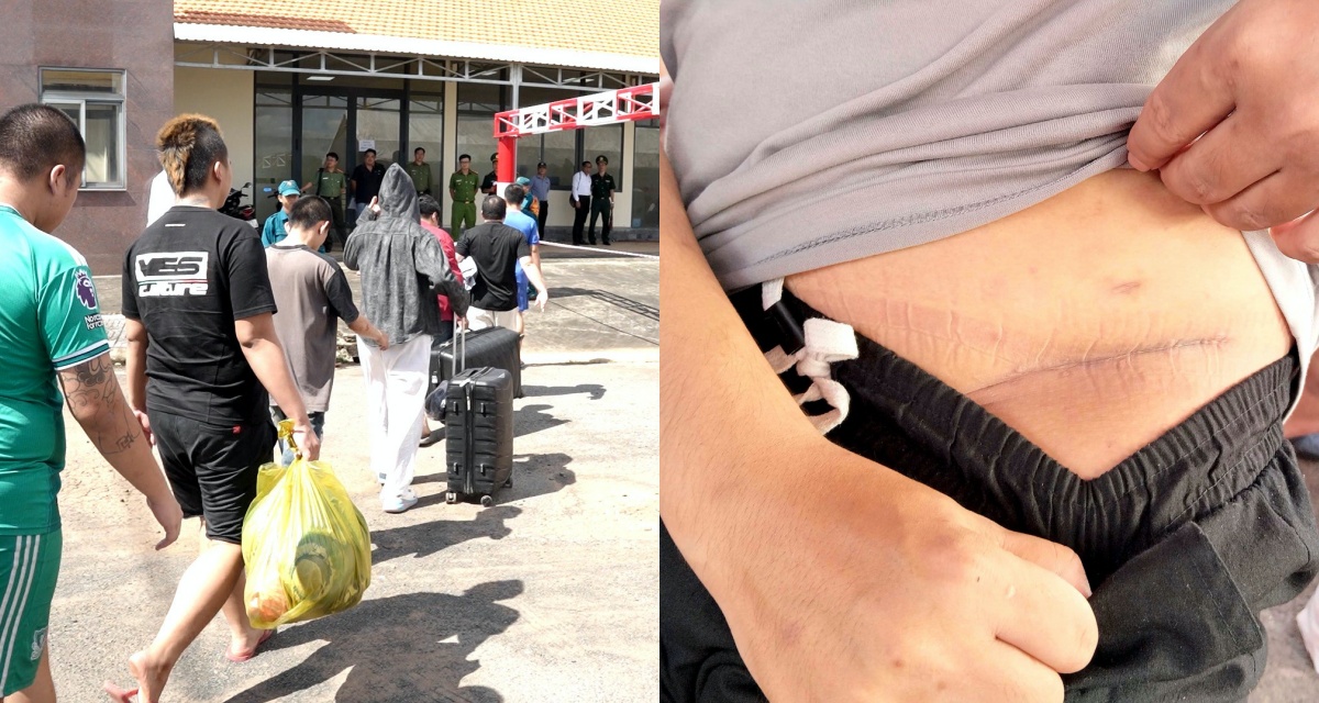 Tin lời &lsquo;việc nhẹ lương cao&rsquo; sang Campuchia, nam thanh ni&ecirc;n bị cưỡng &eacute;p cắt thận: H&agrave;nh tr&igrave;nh trở về &aacute;m ảnh suốt đời