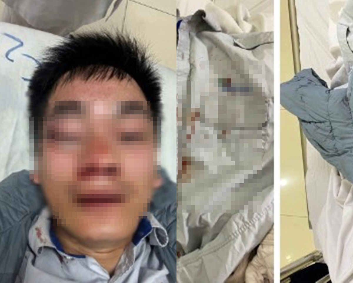 Vợ t&agrave;i xế xe bu&yacute;t bị đ&aacute;nh đến chấn thương sọ n&atilde;o ở H&agrave; Nội tiết lộ th&ocirc;ng tin quan trọng về hung thủ