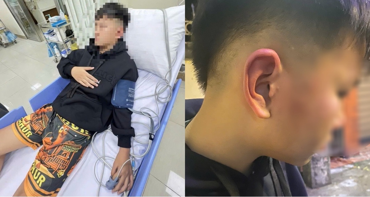 C&ocirc;ng an v&agrave;o cuộc vụ ch&aacute;u b&eacute; bị bố của bạn học đ&aacute;nh khi đến nh&agrave; chơi, h&eacute; lộ nguồn cơn sự việc