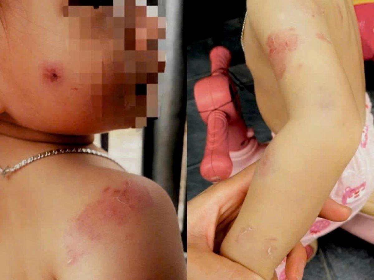 Vụ b&eacute; hơn 2 tuổi ở H&agrave; Tĩnh chi ch&iacute;t vết cắn: Camera t&ecirc; liệt, một c&acirc;u n&oacute;i khiến phụ huynh phẫn nộ