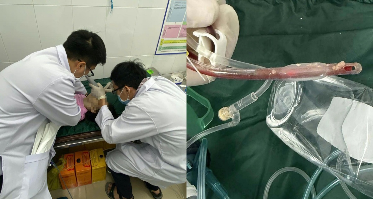 B&eacute; 3 tuổi tử vong tại cơ sở mẫu gi&aacute;o TPHCM, c&ocirc;ng an điều tra nguy&ecirc;n nh&acirc;n g&acirc;y sốc