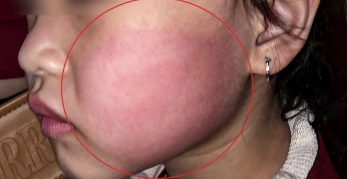 B&eacute; g&aacute;i 4 tuổi đứng nhảy trước nh&agrave; bất ngờ bị người lạ t&aacute;t mạnh, camera tiết lộ t&igrave;nh tiết bất ngờ