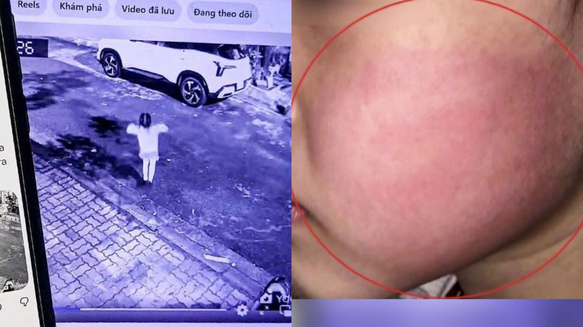 Th&ocirc;ng tin mới vụ b&eacute; g&aacute;i 4 tuổi bị người lạ t&aacute;t: Gia đ&igrave;nh l&ecirc;n tiếng đ&iacute;nh ch&iacute;nh