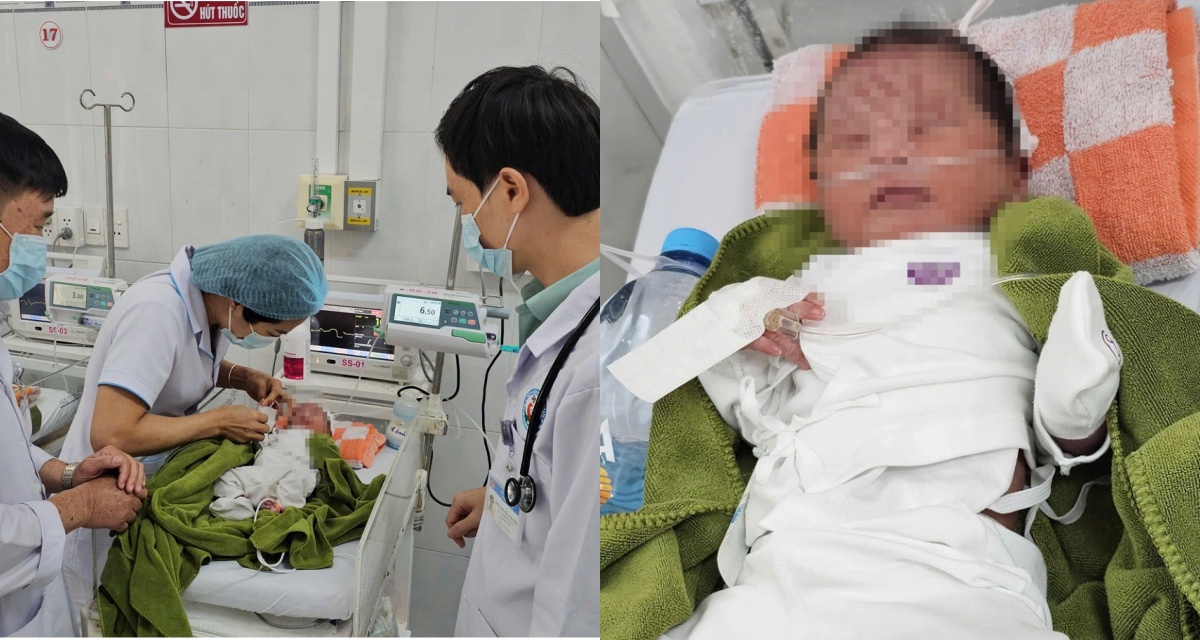 T&igrave;nh trạng v&agrave; cuộc sống hiện tại của b&eacute; g&aacute;i bị v&ugrave;i lấp ở vườn cao su Gia Lai: Th&ocirc;ng tin kết quả t&igrave;m người th&acirc;n 