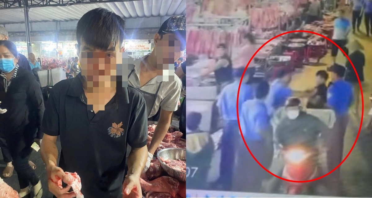 Nguồn cơn vụ bảo vệ chợ H&oacute;c M&ocirc;n đ&aacute;nh c&ocirc;ng nh&acirc;n bốc xếp g&atilde;y mũi, phải nhập viện cấp cứu