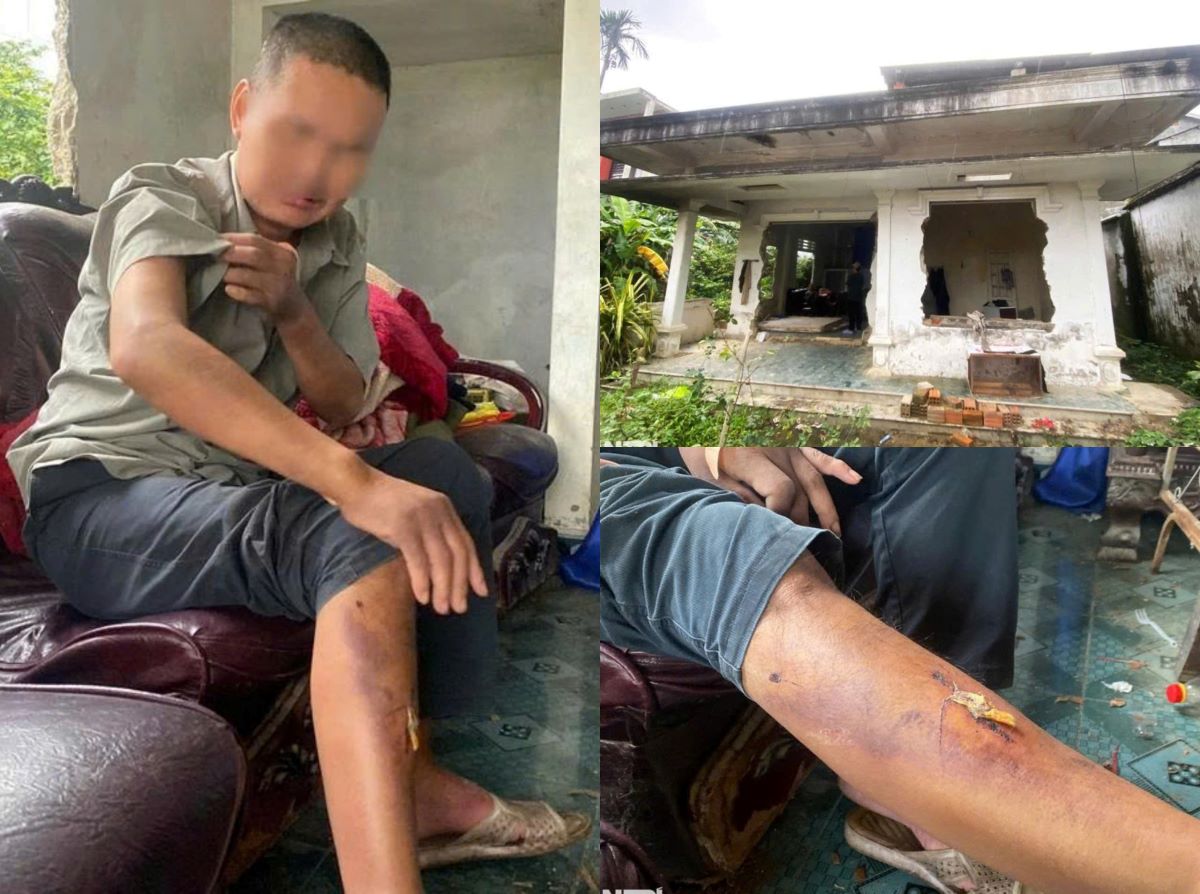 Vụ người đ&agrave;n &ocirc;ng bị nh&oacute;m học sinh lột đồ, h&agrave;nh hung hơn 10 lần ở Huế: H&eacute; lộ gia cảnh bất hảo