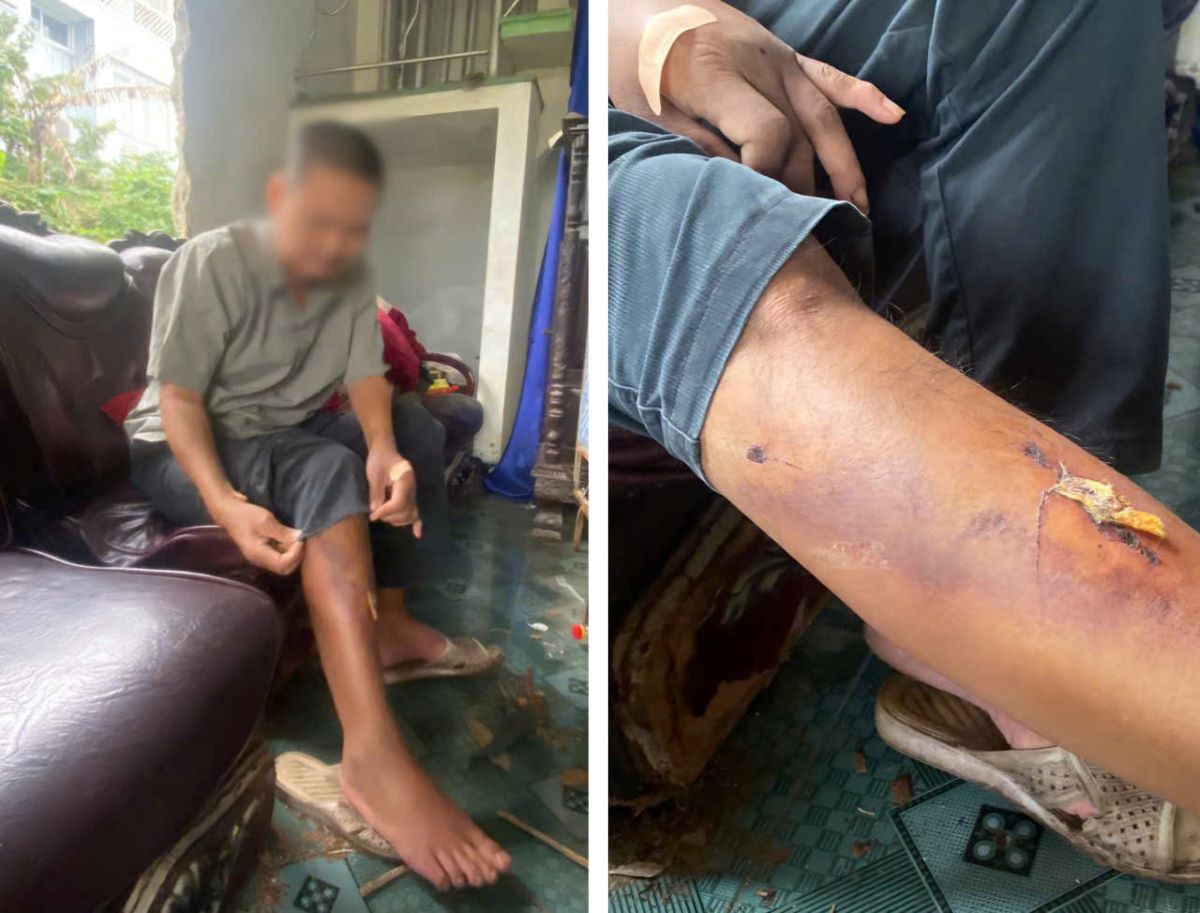 Th&ocirc;ng tin n&oacute;ng vụ người đ&agrave;n &ocirc;ng bị nh&oacute;m học sinh đ&aacute;nh hơn 10 lần: Ch&iacute;nh quyền l&ecirc;n tiếng