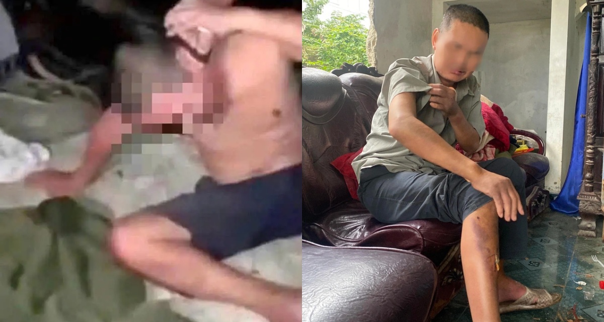 Vụ người đ&agrave;n &ocirc;ng bị nh&oacute;m học sinh h&agrave;nh hạ ở Huế: Ch&iacute;nh quyền l&ecirc;n tiếng, h&eacute; lộ diễn biến bức x&uacute;c, xử l&yacute; ra sao? 