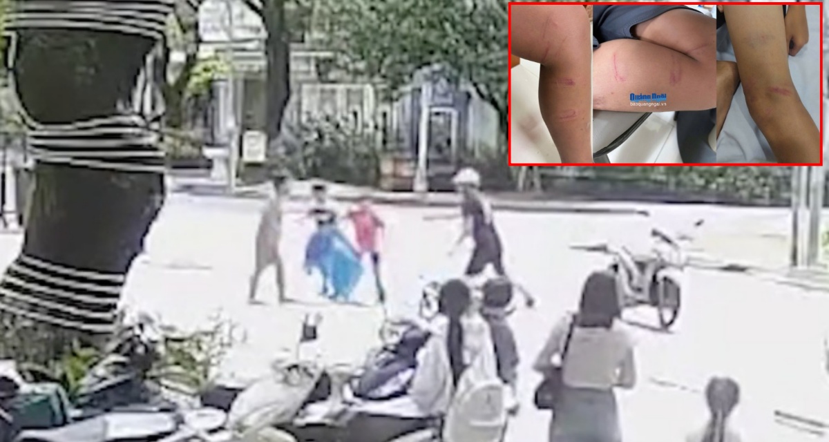 Người đ&agrave;n &ocirc;ng chặn đường, đ&aacute;nh 3 b&eacute; trai ở Quảng Ng&atilde;i: Khai nhận l&yacute; do n&oacute;ng giận ra tay g&acirc;y bức x&uacute;c