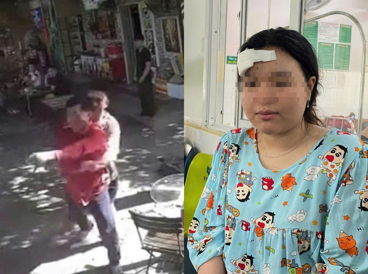 C&ocirc; g&aacute;i nhập viện kh&acirc;u 4 mũi sau khi nhắc nhở người đ&agrave;n &ocirc;ng &lsquo;đ&aacute; l&ocirc;ng nheo&rsquo; bất lịch sự