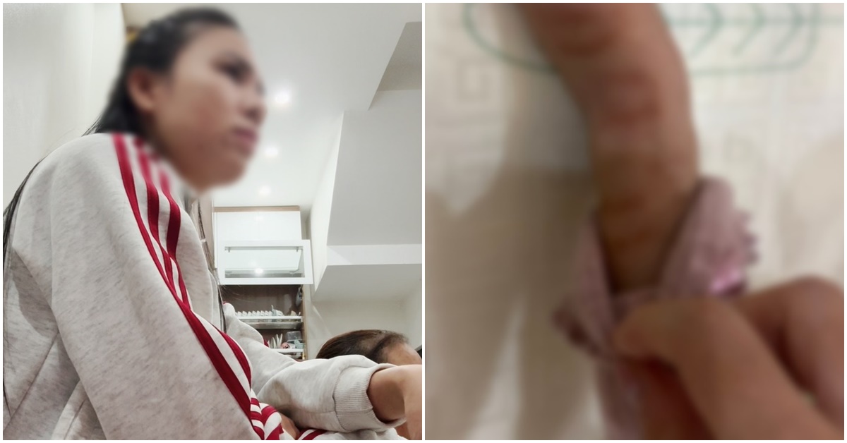 Phẫn nộ l&yacute; do kh&ocirc;ng thể chấp nhận của c&ocirc; gi&aacute;o mầm non nghi tương t&aacute;c trẻ t&iacute;m t&aacute;i tay ch&acirc;n kh&ocirc;ng thể đi lại