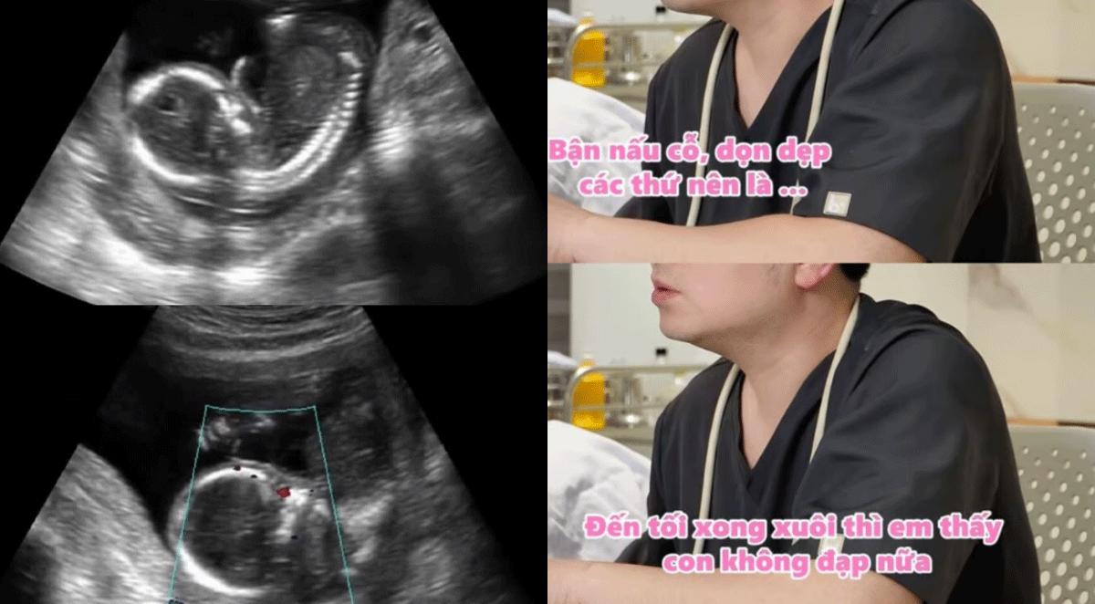 X&oacute;t xa vụ mẹ chồng buộc con d&acirc;u về qu&ecirc; l&agrave;m cỗ d&ugrave; b&aacute;c sĩ cảnh b&aacute;o cần dưỡng thai: Thai phụ đ&atilde; mất con