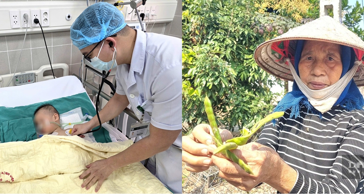 Sức khỏe bệnh nhi 19 th&aacute;ng bị nặng nhất vụ ngộ độc hạt củ đậu, b&aacute;c sĩ h&eacute; lộ t&igrave;nh h&igrave;nh khi nhập viện