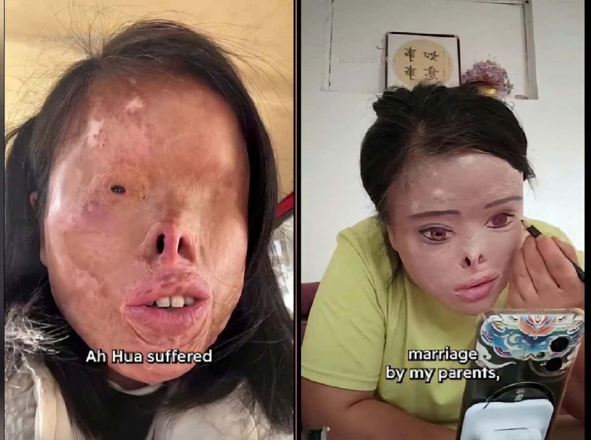 Bị chồng cũ tạt axit m&ugrave; mắt: Người phụ nữ g&acirc;y sốc khi tự &lsquo;vẽ&rsquo; lại dung nhan để đổi đời