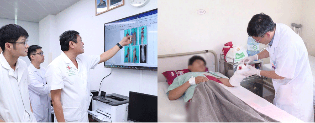 Gia đ&igrave;nh hoảng sợ khi con trai 15 tuổi gặp tai nạn khi ph&aacute;o tự chế ph&aacute;t nổ: Mất vĩnh viễn 2 ng&oacute;n tay