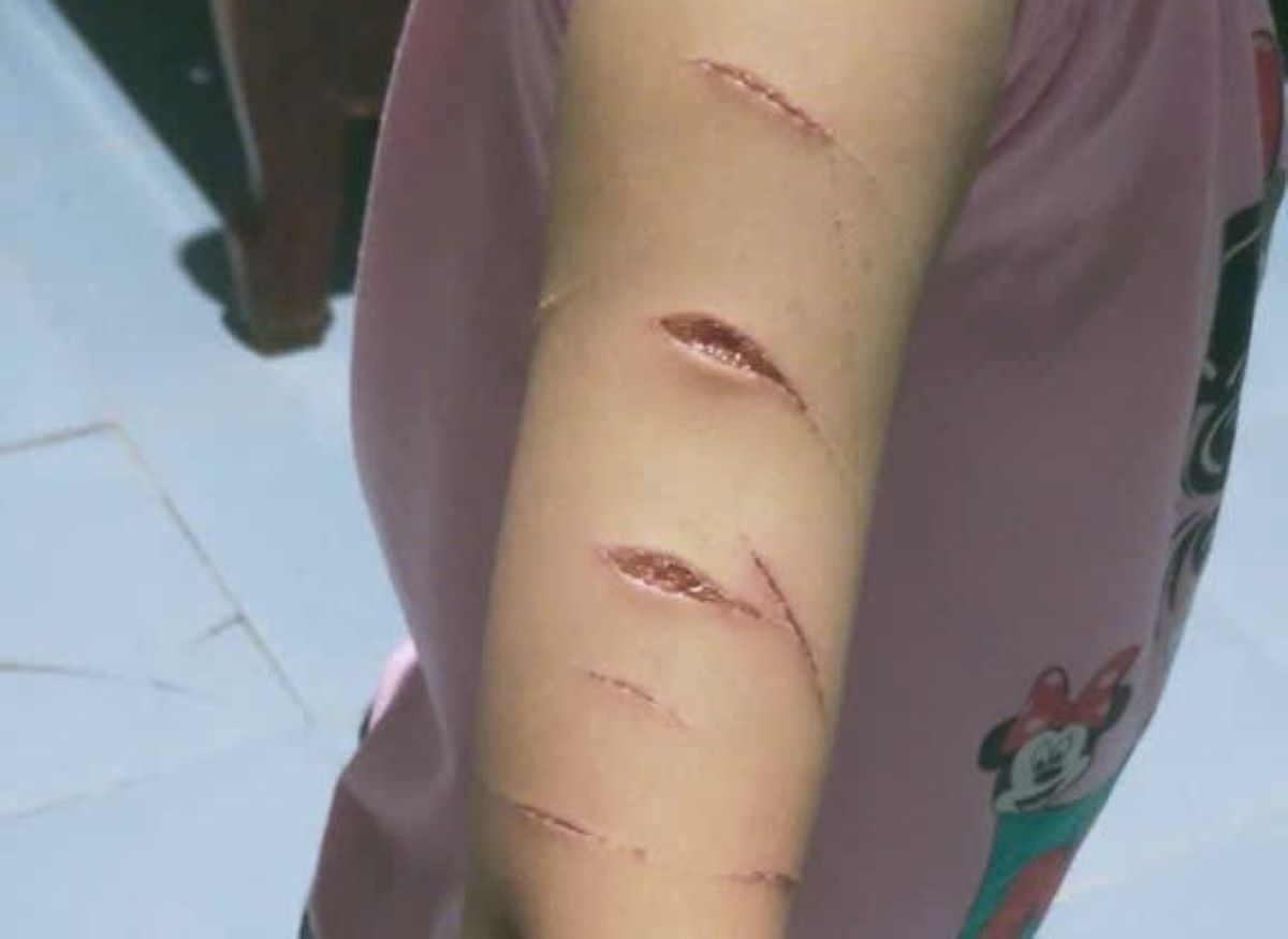 X&oacute;t xa vụ b&eacute; g&aacute;i 12 tuổi bị chị họ rạch n&aacute;t tay: Hiện trường ph&ograve;ng ngủ h&eacute; lộ sự thật &aacute;m ảnh