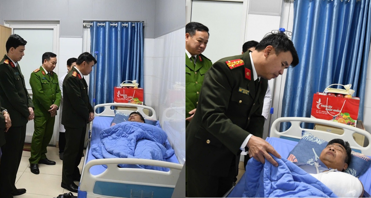 T&igrave;nh h&igrave;nh tổ trưởng bảo vệ an ninh sau khi bị đối tượng hung h&atilde;n d&ugrave;ng &lsquo;h&agrave;ng n&oacute;ng&rsquo; tấn c&ocirc;ng d&atilde; man