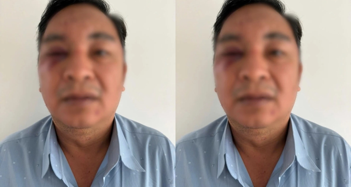 C&ocirc;ng an x&aacute;c định nguồn cơn vụ 2 nam 1 nữ x&ocirc;ng v&agrave;o đ&aacute;nh, nổ s&uacute;ng với một người đ&agrave;n &ocirc;ng ở Đồng Nai