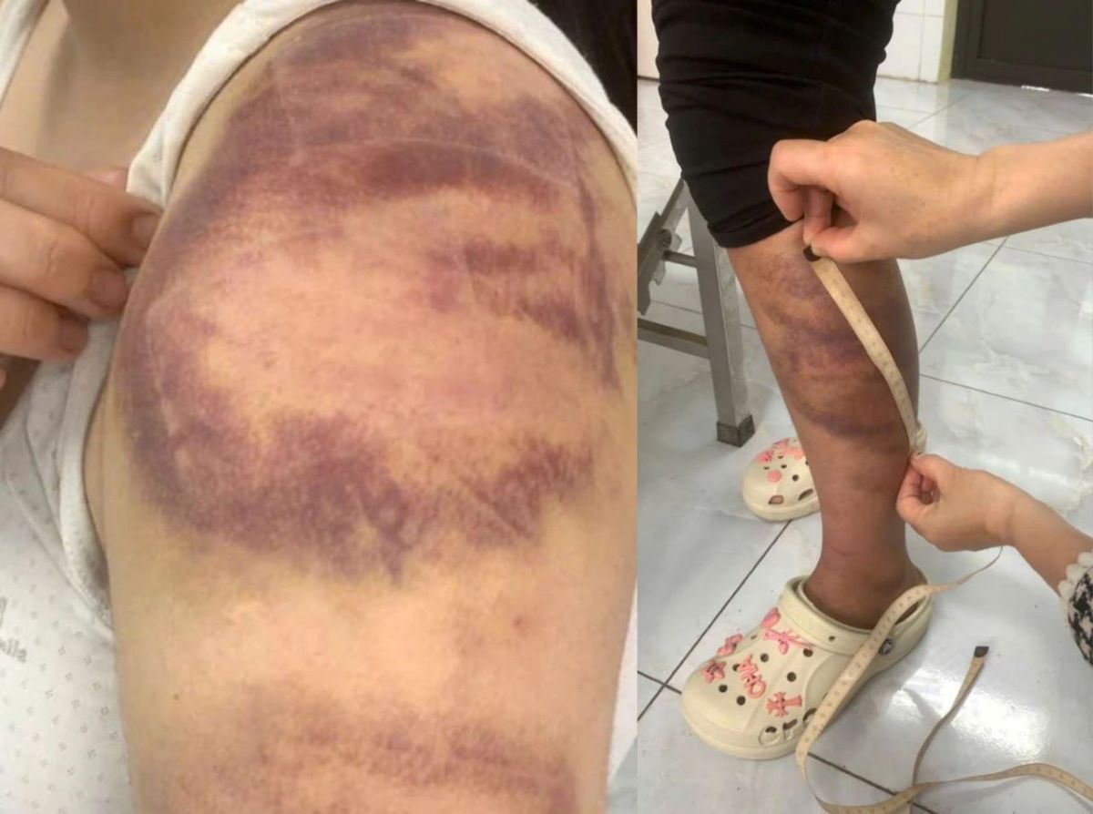 Lời khai của g&atilde; đ&agrave;n &ocirc;ng h&agrave;nh hạ vợ mang thai v&agrave; con g&aacute;i 13 tuổi suốt nhiều ng&agrave;y ở Bắc Ninh