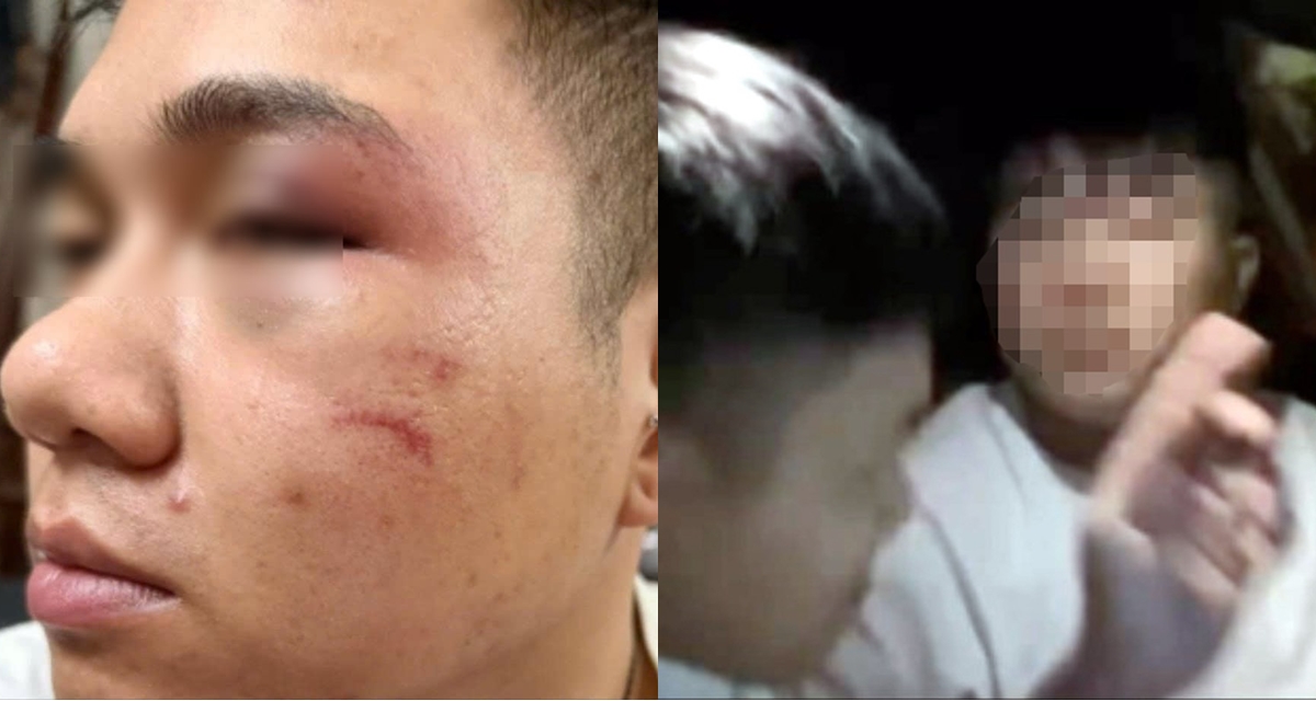 T&agrave;i xế hứng đ&ograve;n v&igrave; từ chối chở người say xỉn: Nạn nh&acirc;n bị người phụ nữ giữ lại để nam thanh ni&ecirc;n ra tay