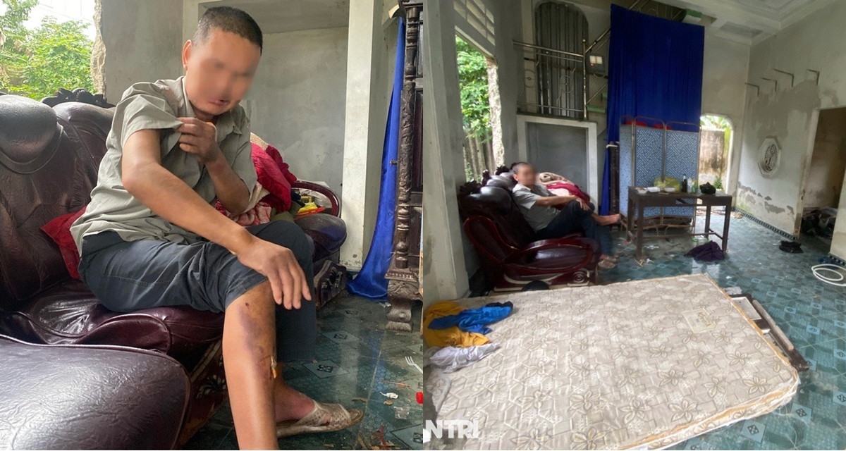 Đ&atilde; xử phạt nh&oacute;m học sinh h&agrave;nh hạ người đ&agrave;n &ocirc;ng ở Huế, bất ngờ t&igrave;nh h&igrave;nh của nạn nh&acirc;n hiện tại