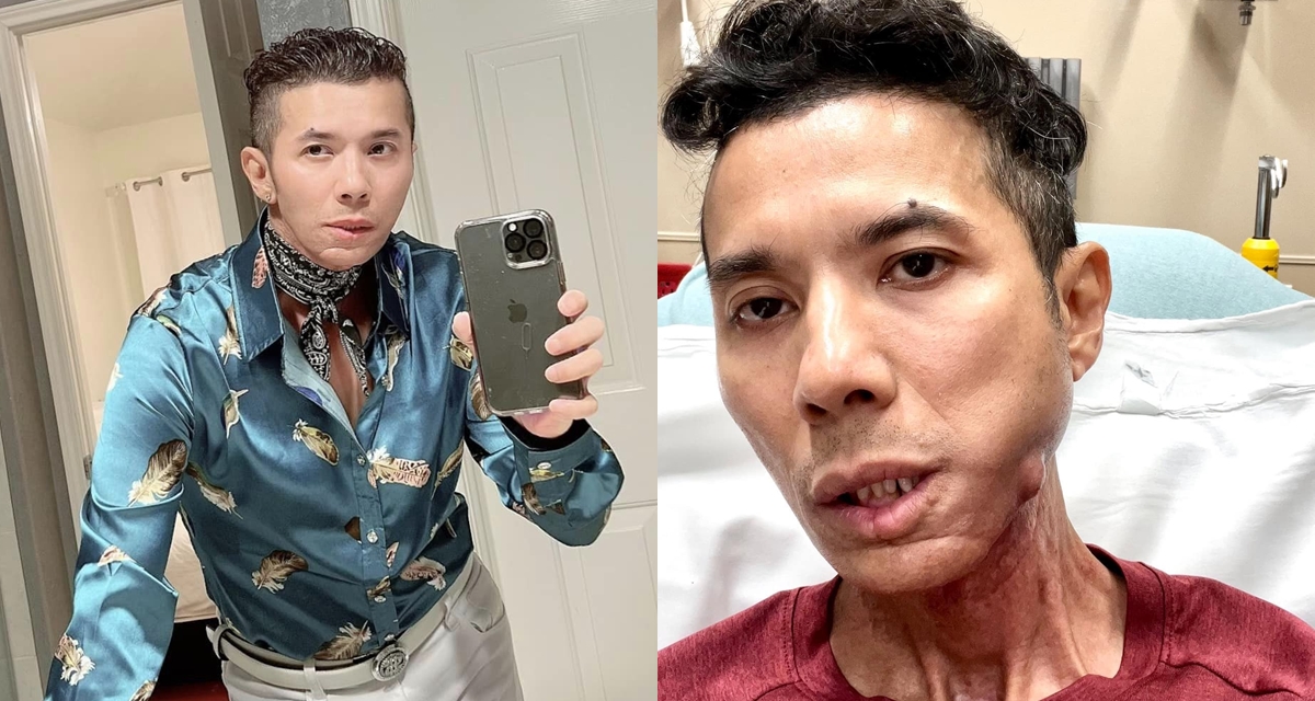 X&oacute;t xa chia sẻ cuối c&ugrave;ng của Kasim Ho&agrave;ng Vũ, h&eacute; lộ t&igrave;nh cảnh cuối đời đầy &eacute;o le của nam ca sĩ