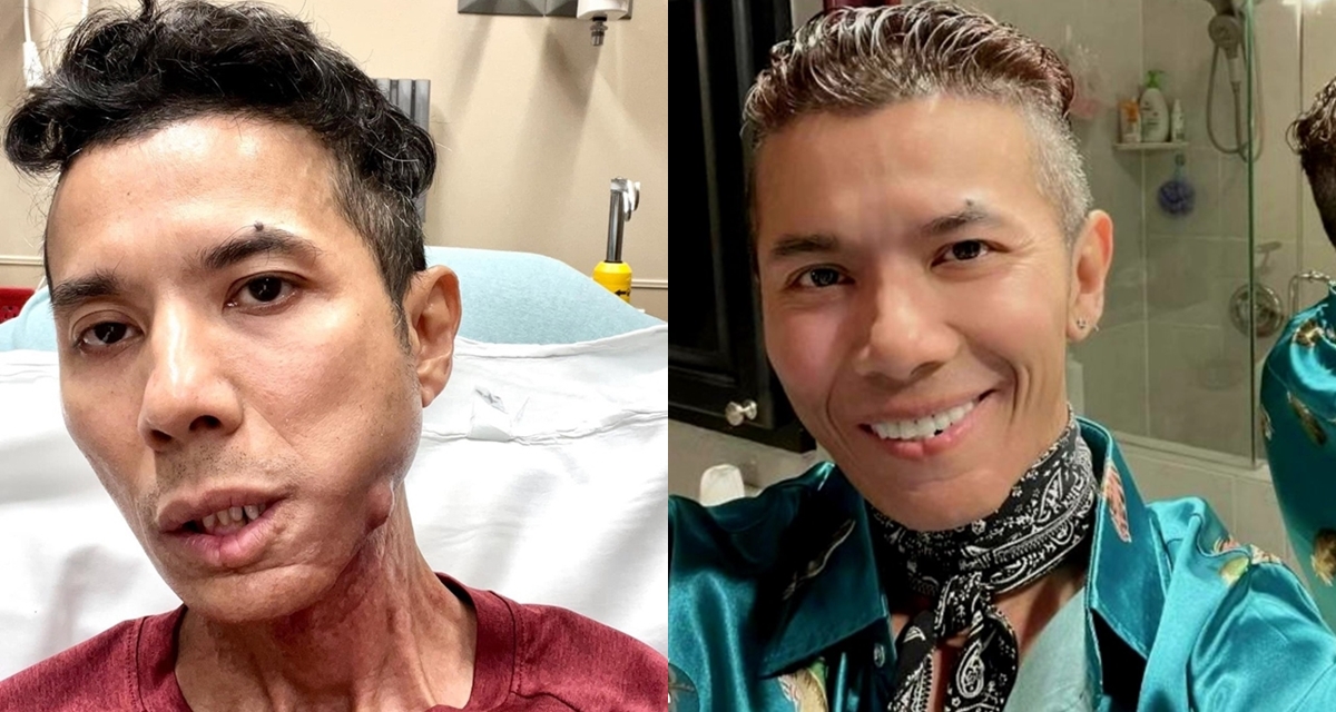 T&igrave;nh trạng đau đớn của Kasim Ho&agrave;ng Vũ những ng&agrave;y cuối đời, bạn th&acirc;n tiết lộ t&acirc;m nguyện của nam ca sĩ