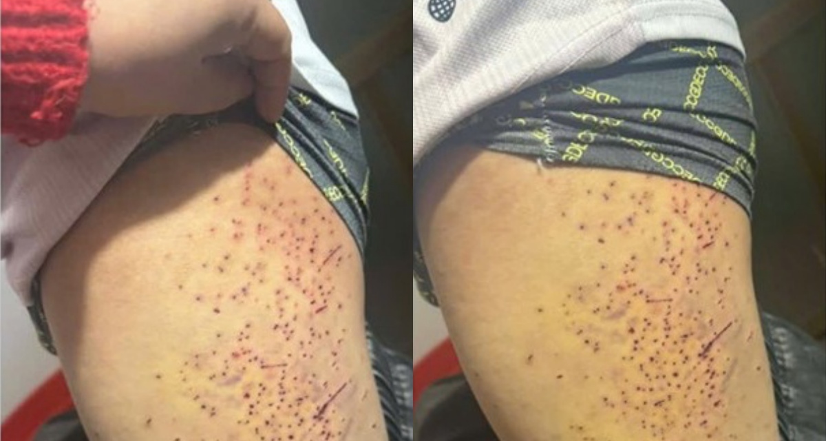 Th&ocirc;ng tin học sinh nghi bị bạn d&ugrave;ng vật nhọn g&acirc;y thương t&iacute;ch ở L&agrave;o Cai: Ch&iacute;nh quyền l&ecirc;n tiếng