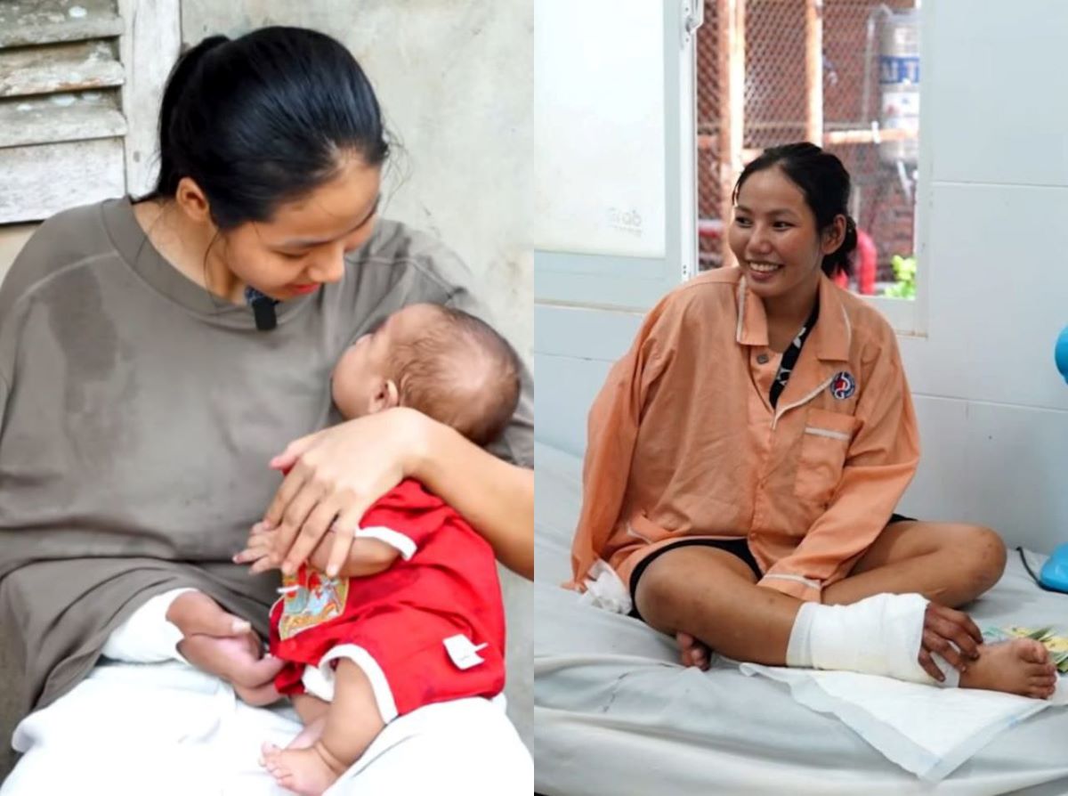 Sản phụ 18 tuổi gh&eacute;p b&agrave;n tay đứt l&igrave;a v&agrave;o ch&acirc;n hiện ra sao sau ca sinh đ&ocirc;i đầy nghẹt thở?