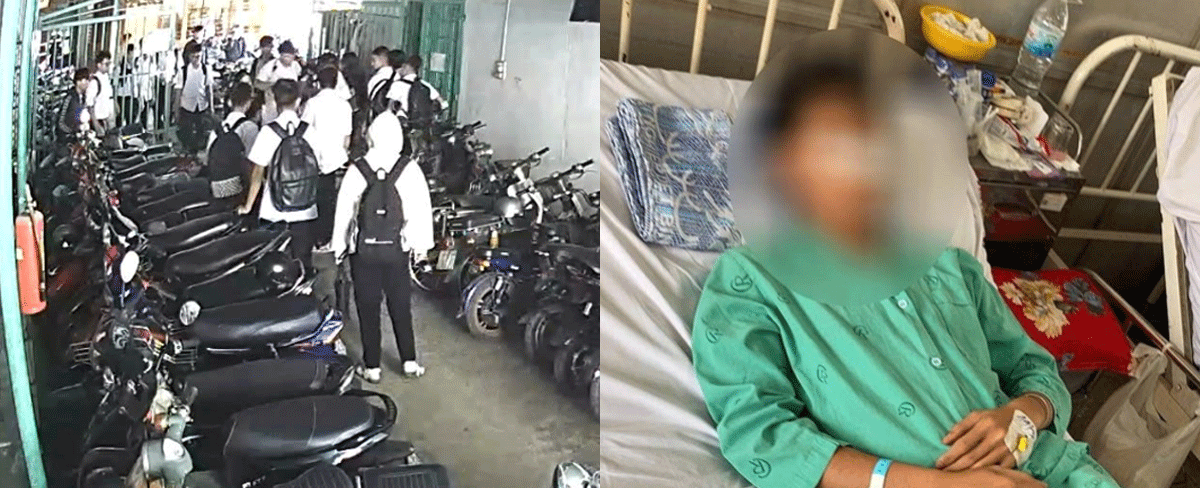 Nam sinh lớp 11 bị nh&oacute;m lớp 10 h&agrave;nh hung ở nh&agrave; xe phải nhập viện: Nguồn cơn v&agrave; t&igrave;nh h&igrave;nh nạn nh&acirc;n