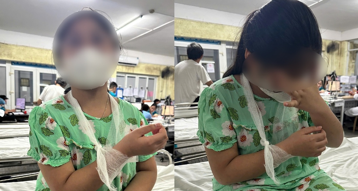 Vụ học sinh lớp 4 bị đ&aacute;nh chấn thương tay: C&ocirc; gi&aacute;o thừa nhận mọi việc, nh&agrave; trường n&ecirc;u hướng xử l&yacute;