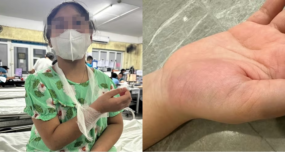 Vụ học sinh lớp 4 bị c&ocirc; gi&aacute;o đ&aacute;nh v&agrave;o tay: Th&ocirc;ng tin từ bệnh viện, gi&aacute;o vi&ecirc;n bất ngờ trước kết quả kh&aacute;m