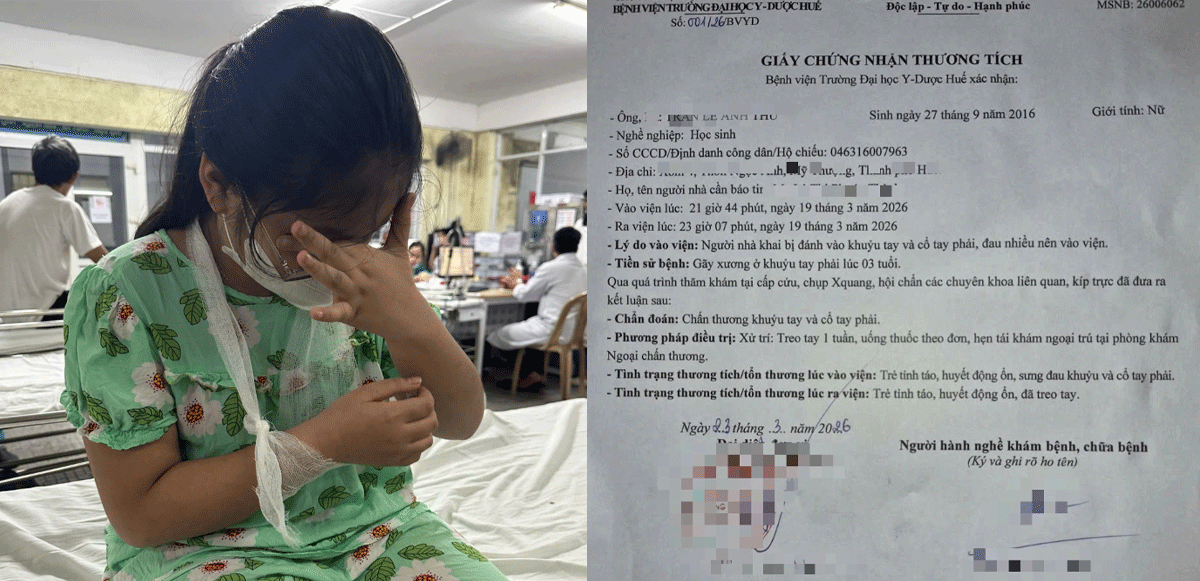 Vụ c&ocirc; gi&aacute;o đ&aacute;nh học sinh phải b&oacute; bột ở Huế: Diễn biến mới qu&aacute; tr&igrave;nh xử l&yacute; vụ việc? T&igrave;nh h&igrave;nh em nhỏ?