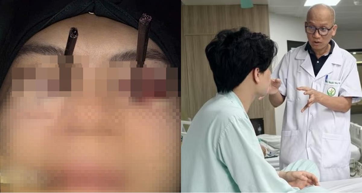 Ph&uacute; Thọ: T&igrave;nh h&igrave;nh thanh ni&ecirc;n bị 2 đũa đ&acirc;m s&acirc;u v&agrave;o 2 mắt, y văn thế giới cũng chưa từng gặp phải