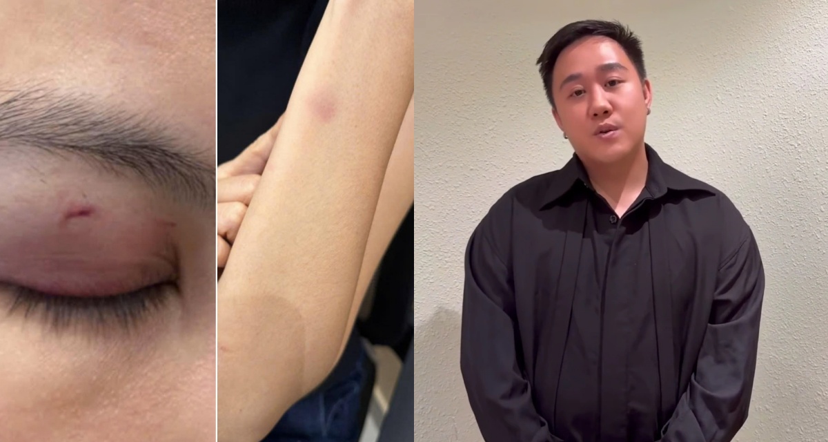 Sau b&agrave;i xin lỗi của ca sĩ Trung Qu&acirc;n Idol v&igrave; h&agrave;nh hung phụ nữ, chồng nạn nh&acirc;n l&ecirc;n tiếng n&oacute;i tất cả