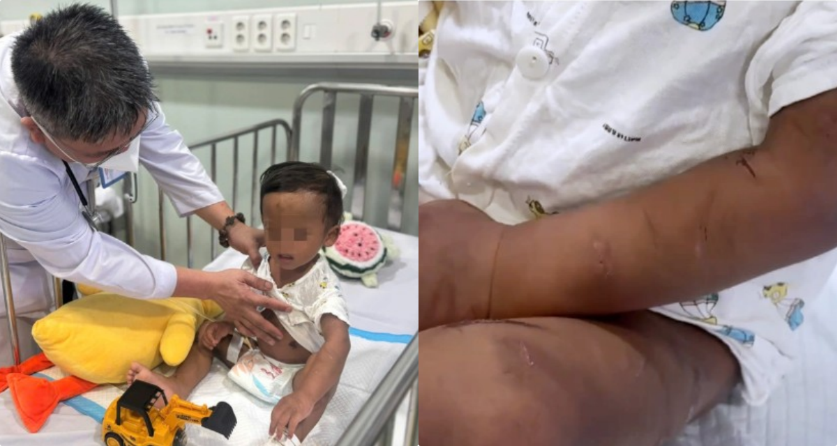 Ho&agrave;n cảnh &eacute;o le, kh&ocirc;ng nơi nương tựa của b&eacute; trai 2 tuổi bị mẹ ruột v&agrave; người t&igrave;nh bạo h&agrave;nh ở TP.HCM