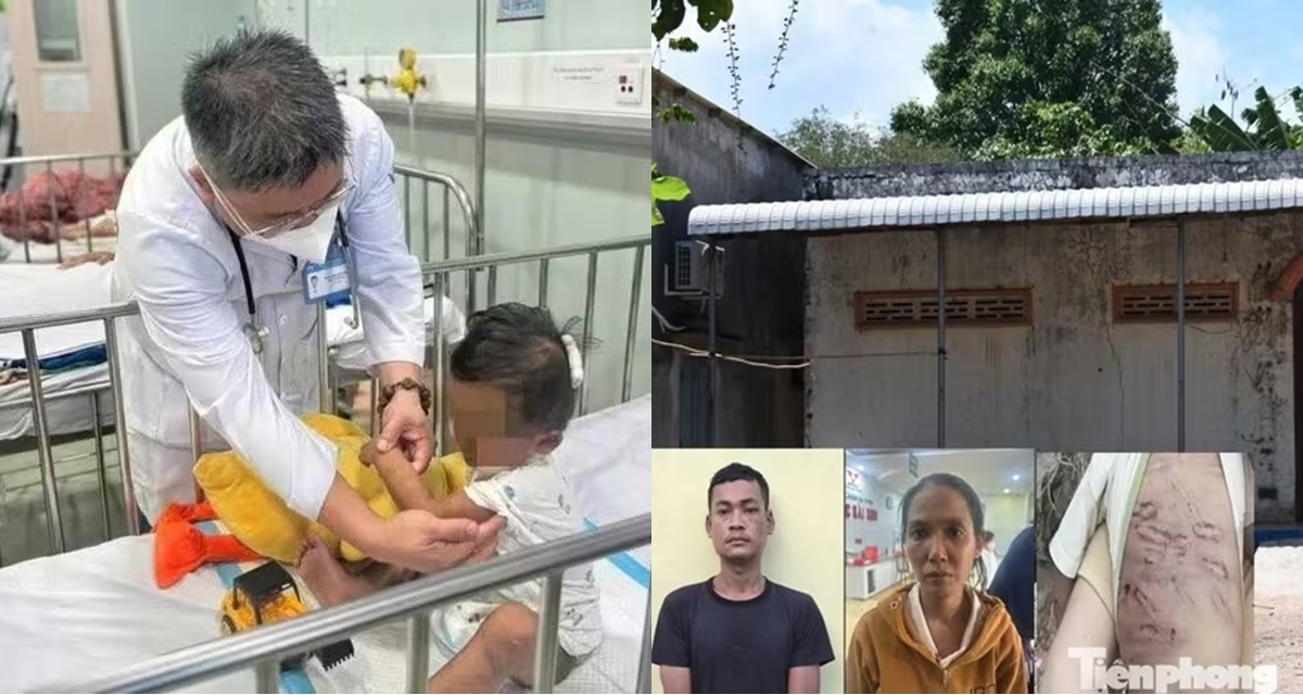 B&eacute; trai 2 tuổi bị mẹ v&agrave; người t&igrave;nh bạo h&agrave;nh: Người th&acirc;n từ chối chăm s&oacute;c, t&igrave;nh h&igrave;nh hiện tại ra sao?