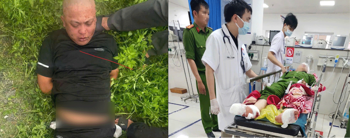 Đại &uacute;y c&ocirc;ng an bị g&atilde; đ&agrave;n &ocirc;ng ch&eacute;m trọng thương tại trụ sở đ&atilde; giữ được t&iacute;nh mạng, t&igrave;nh h&igrave;nh sức khỏe?
