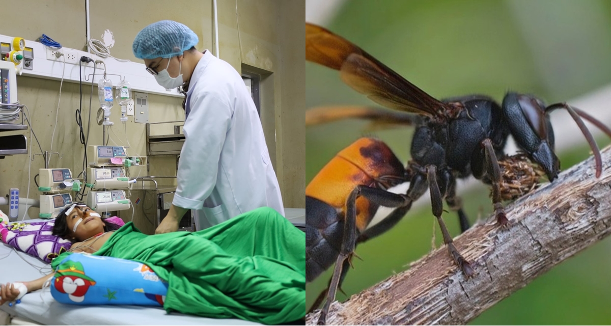 B&eacute; g&aacute;i lớp 4 ở C&agrave; Mau bị ong v&ograve; vẽ đốt hơn 70 vết v&igrave; trốn tr&ecirc;u anh trai, sức khỏe hiện thế n&agrave;o?